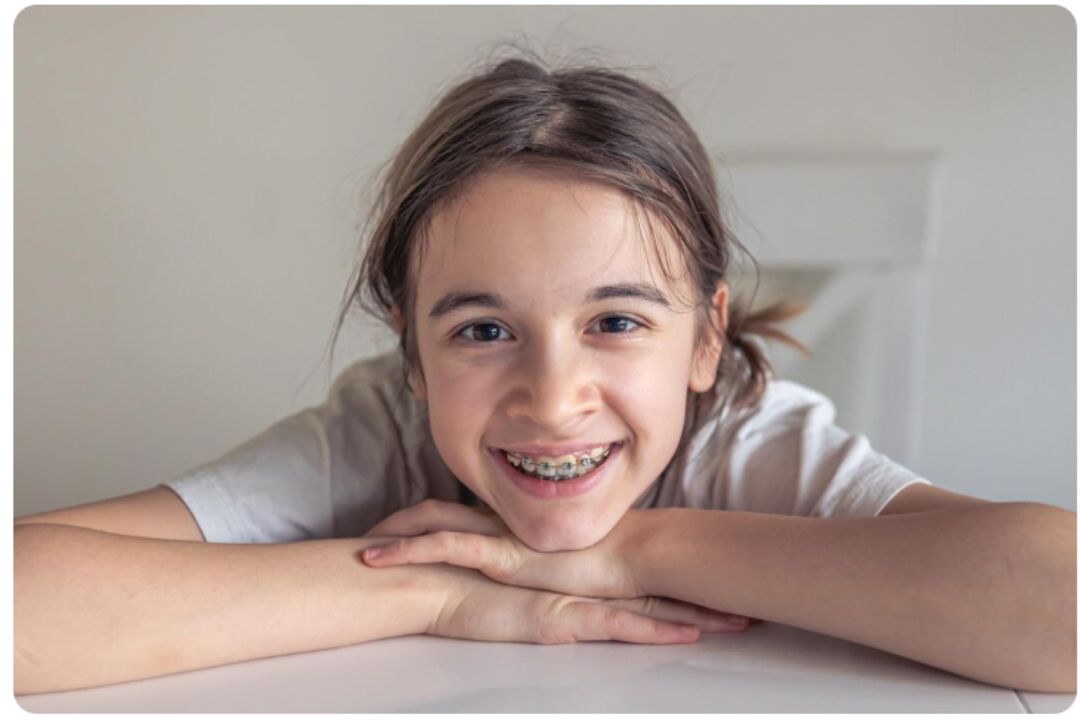 2 year braces cost in india